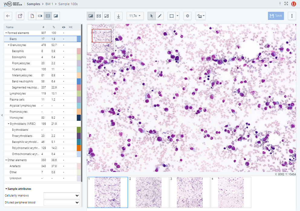 Вкладка “Sample 100x”, режим “Cells on the frame”