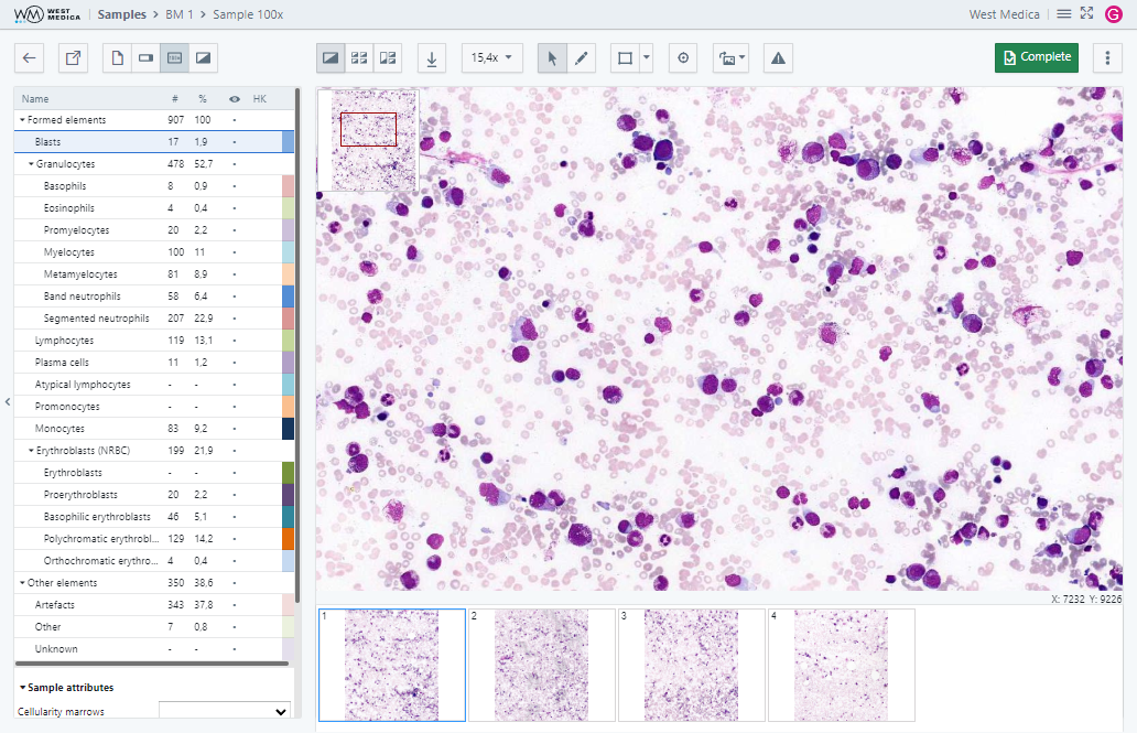 Вкладка “Sample 100x”, режим “Cells on the frame”