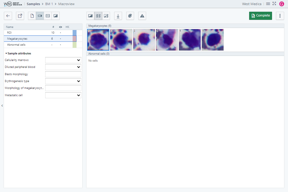 Вкладка “Macroview”, режим “Grouped cells”