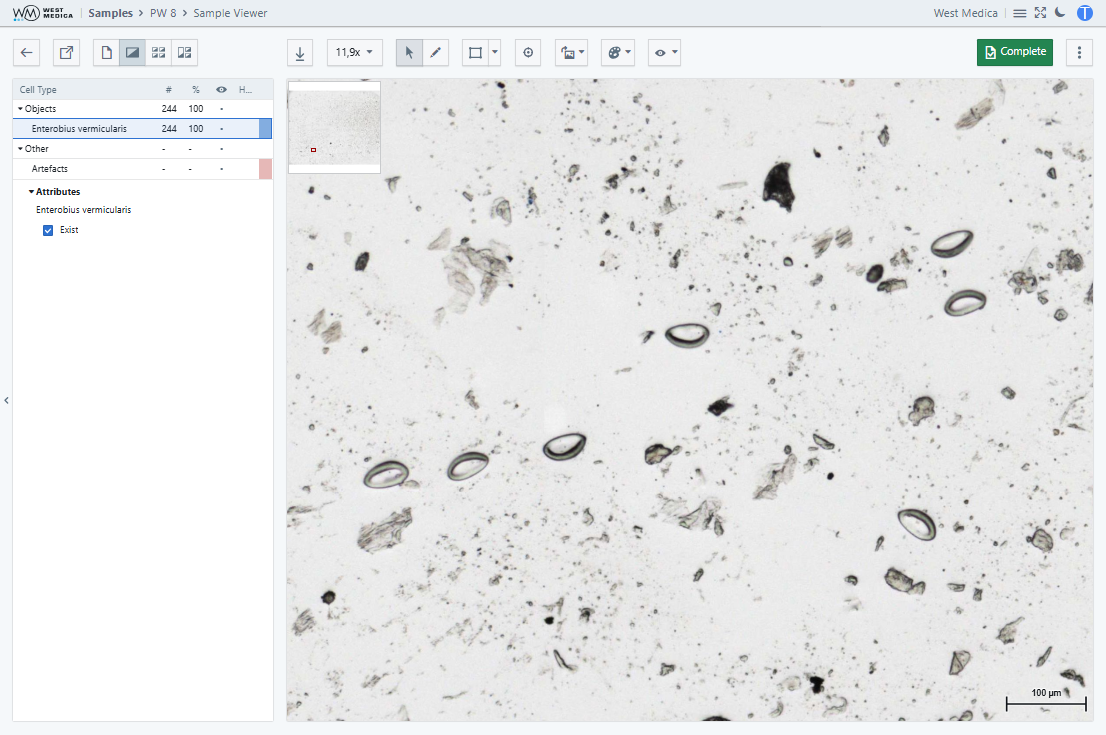 Проба PW, вкладка “Sample Viewer”